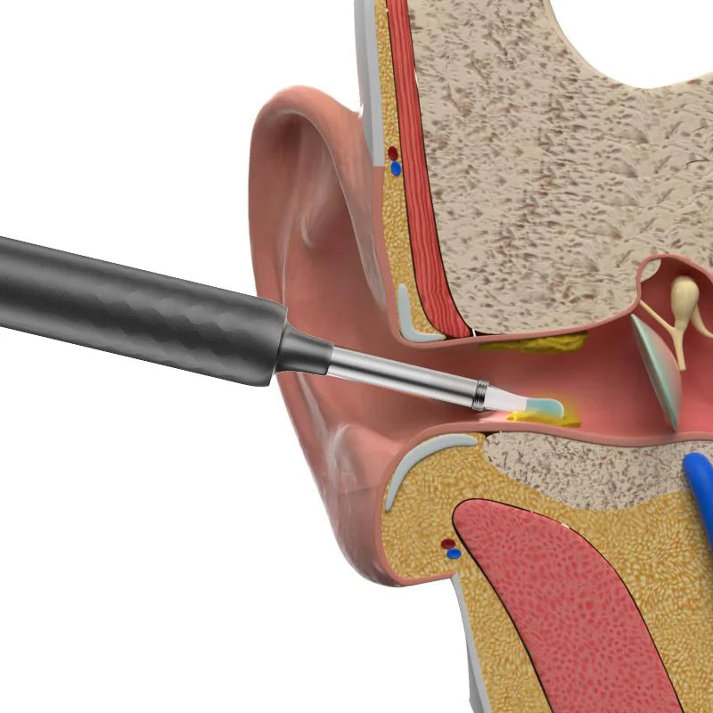 Bebird Ear Cleaner X3 R3 R1 Smart Visual Ear